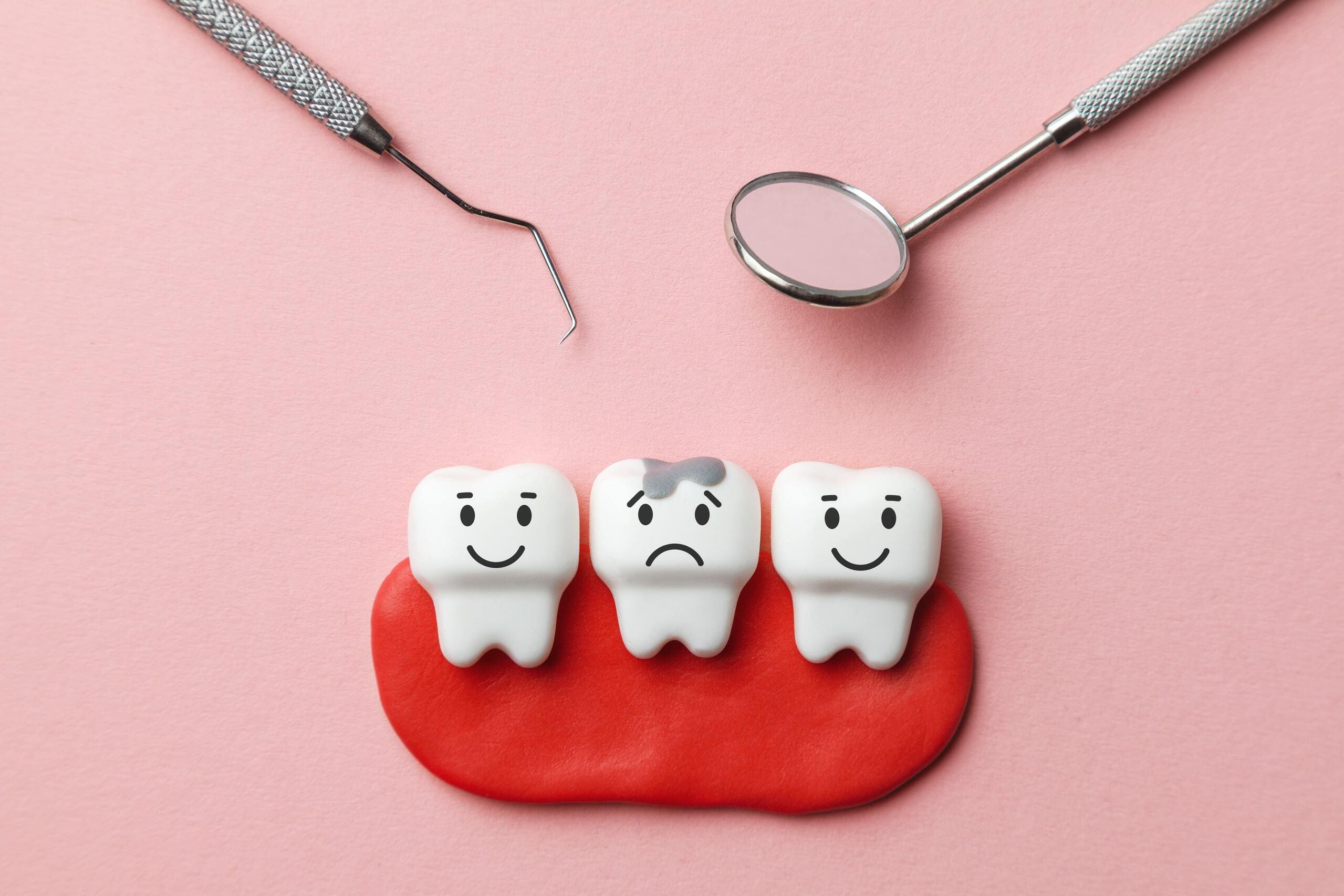 Tooth-Colored Fillings: A Modern Approach to Dental Restoration