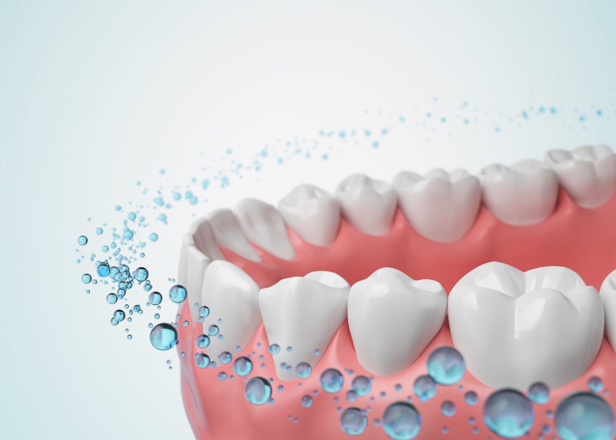 Fluoride Treatments: Are They Still Necessary?