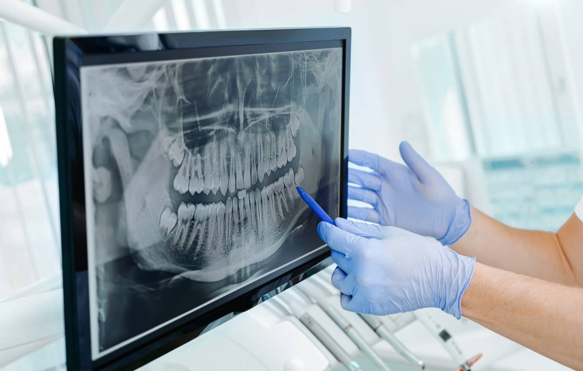 The Importance of Digital X-Rays in Modern Dentistry