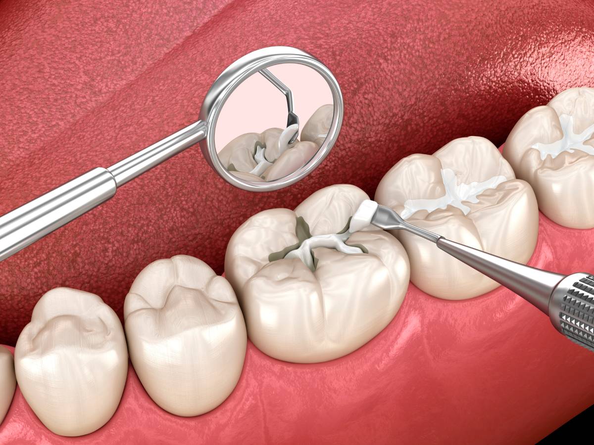 What Counts as a Dental Emergency?
