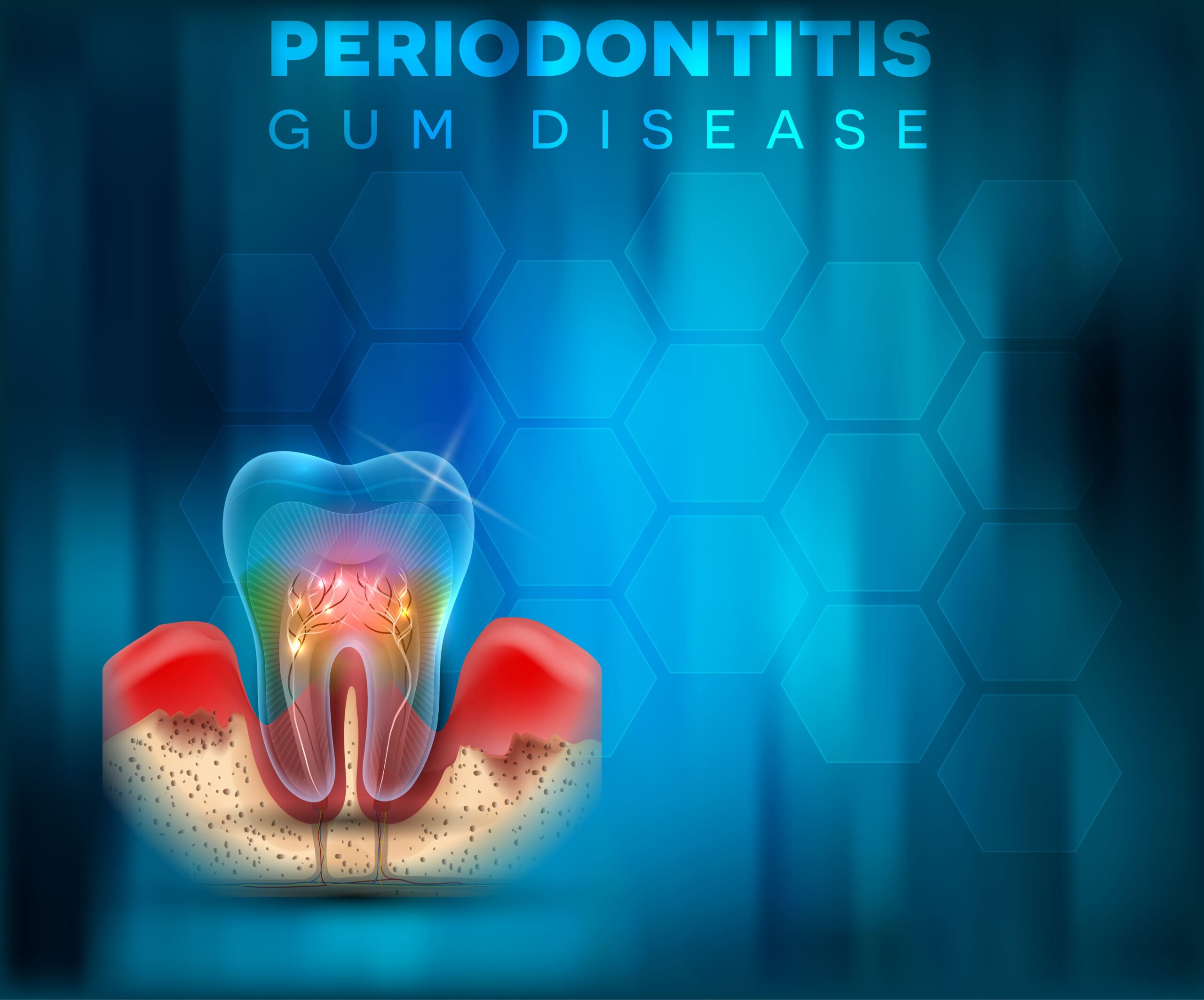Can Gum Disease Be Cured?